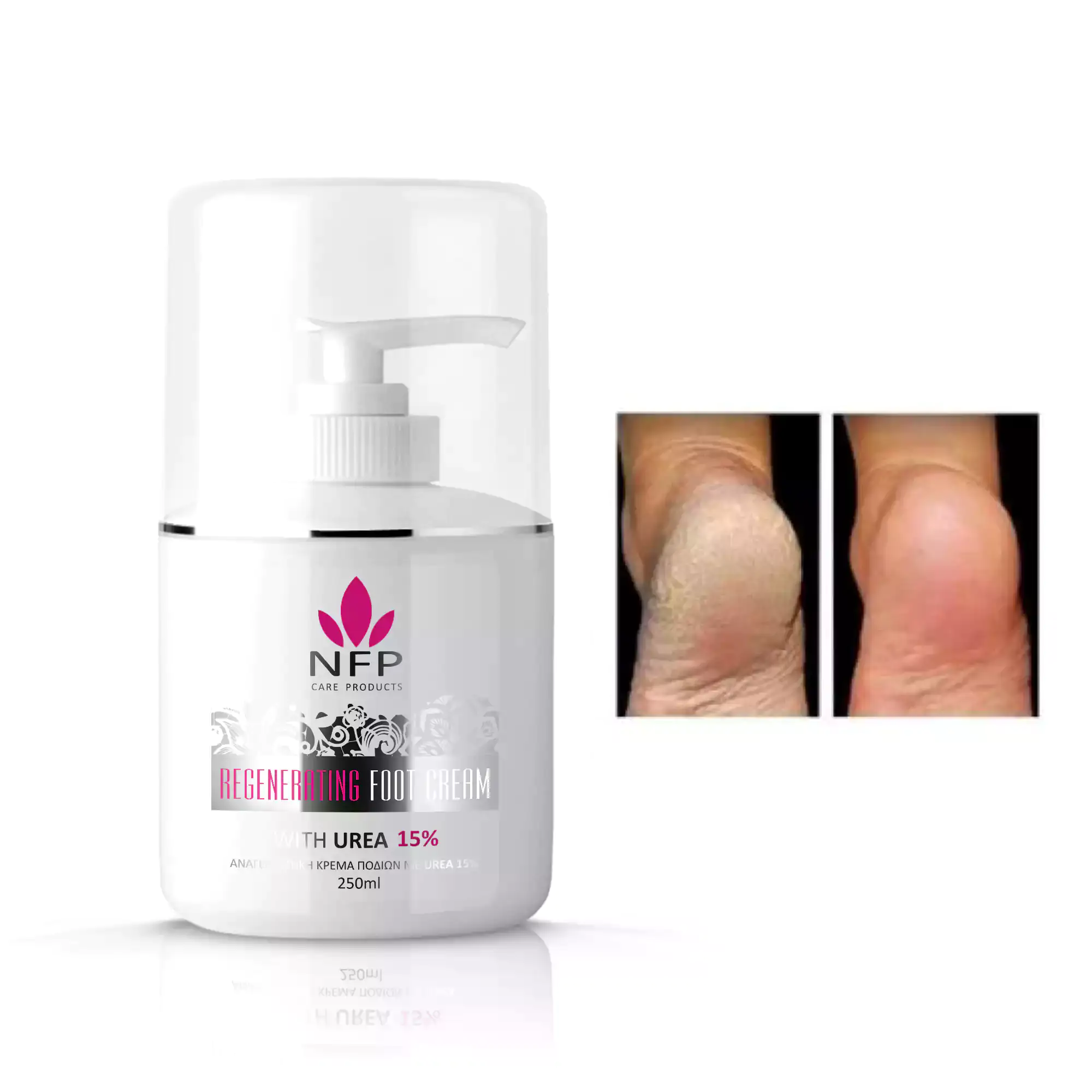 NFP Αναγεννητική Κρέμα Ποδιών Με Ουρία 15% 250ml | Femme Fat - BeautyNet - - Η κρέμα ποδιών NFP είναι σχεδιασμένη για να επιταχύνει την διαδικασία ανάπλασης των νέων υγιών κυττάρων χάρις στις ευεργετικές ιδιότητες της Ουρίας. NFP Αναγεννητική Κρέμα Ποδιών Με Ουρία 15% 250ml | Femme Fat - BeautyNet - Golden Rose Mystic Romance Full Volume Mascara|Beautynet